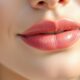 Tren Baru: Implant Bibir Populer di Indonesia